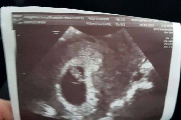 Preparing to become a mum of two after loss